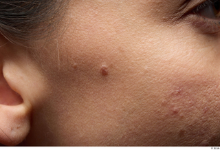 HD Face Skin Zolzaya ear face skin pores skin texture…